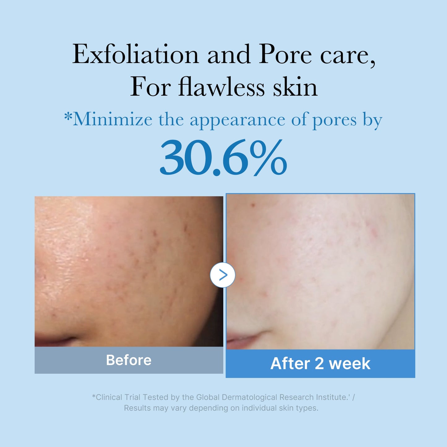 zero-pore-toner-x4 01_d6480b4e-3c08-4954-994a-ed5212c1839c.jpg