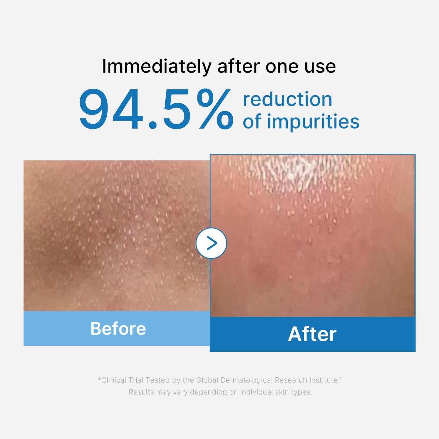 zero-pore-blackhead-deep-cleansing-oil-x3 01_eed557ec-5857-46a2-8b17-dbd67c692dcb.jpg