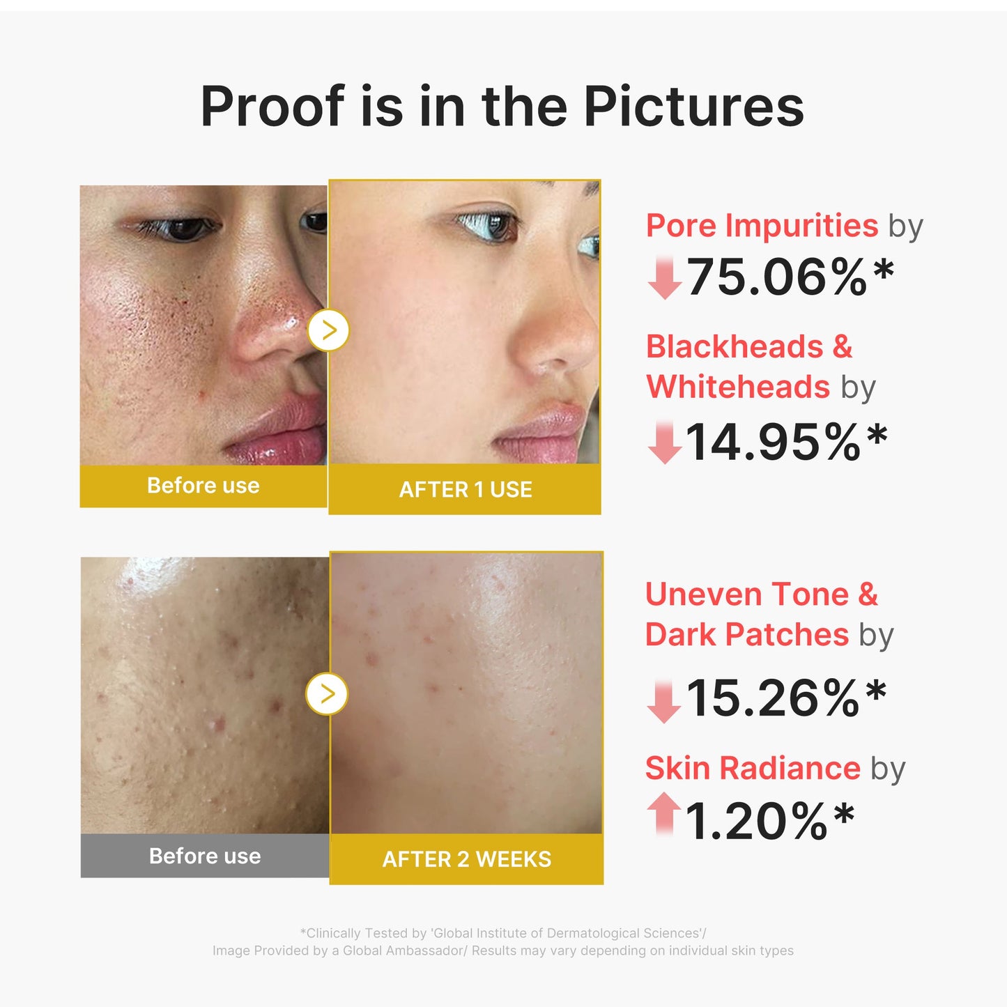 kojic-acid-turmeric-peel-shot-q0 02_45fe66d3-b3f6-4100-aa52-2afd7eded417.jpg