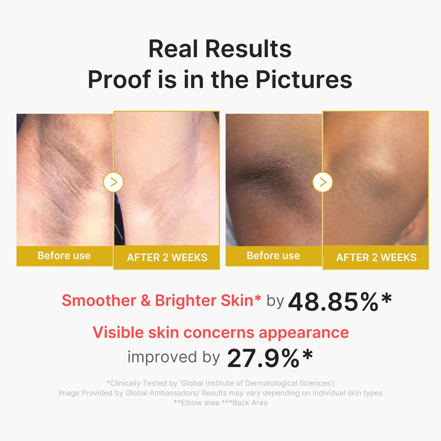 kojic-acid-turmeric-body-peel-shot-o7 02_72880cfc-382b-440b-8152-7e3dce87da2a.jpg