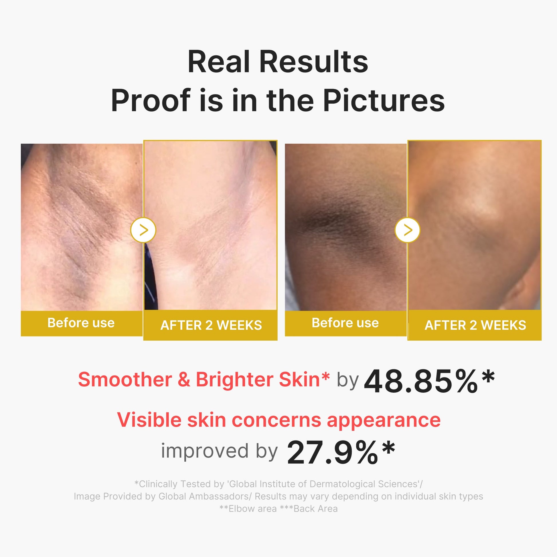kojic-acid-turmeric-body-peel-shot-o7 02_72880cfc-382b-440b-8152-7e3dce87da2a.jpg