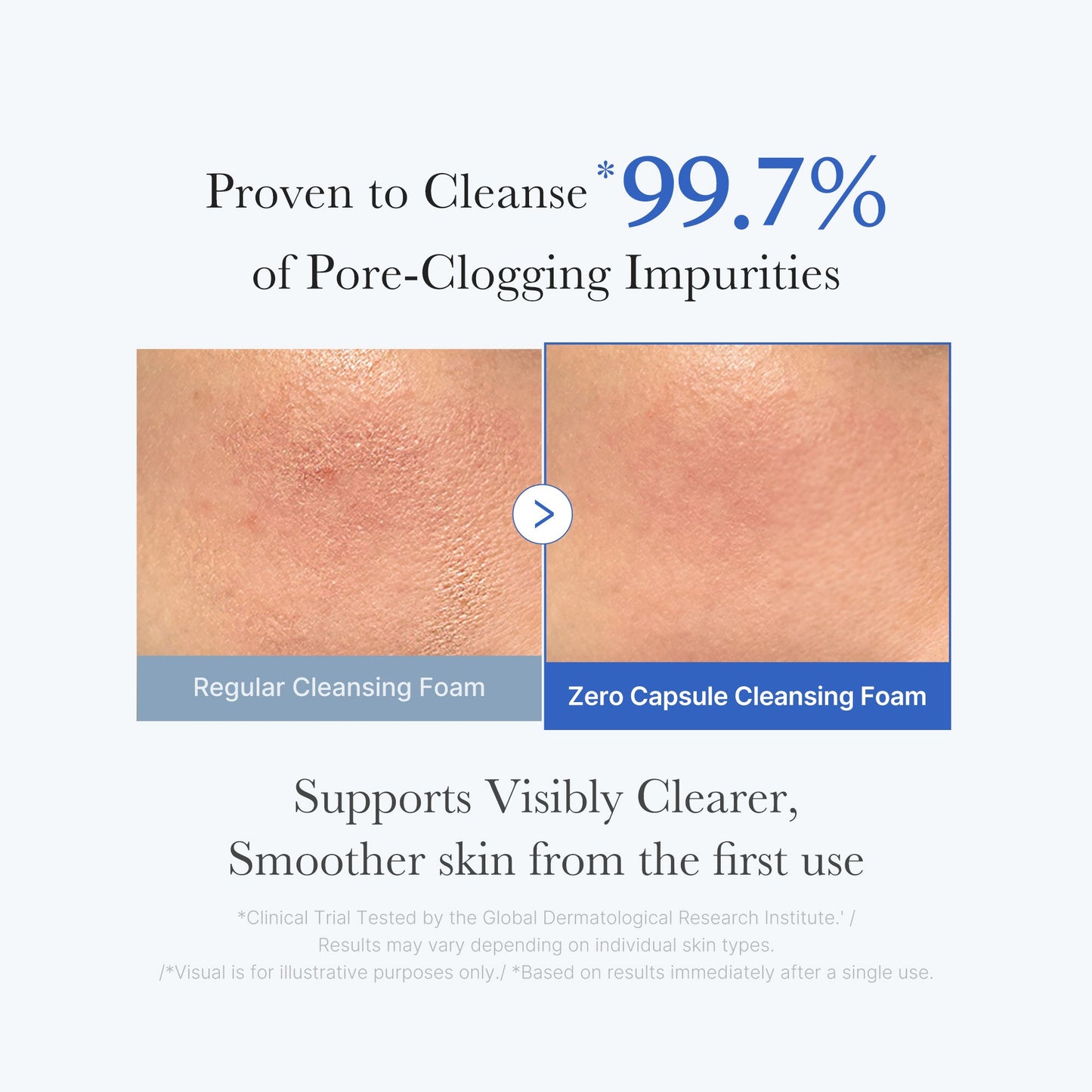 zero-pore-capsule-cleansing-foam-v9 02_c1fb9dfb-86c5-4038-8ff8-490d1006276c.jpg