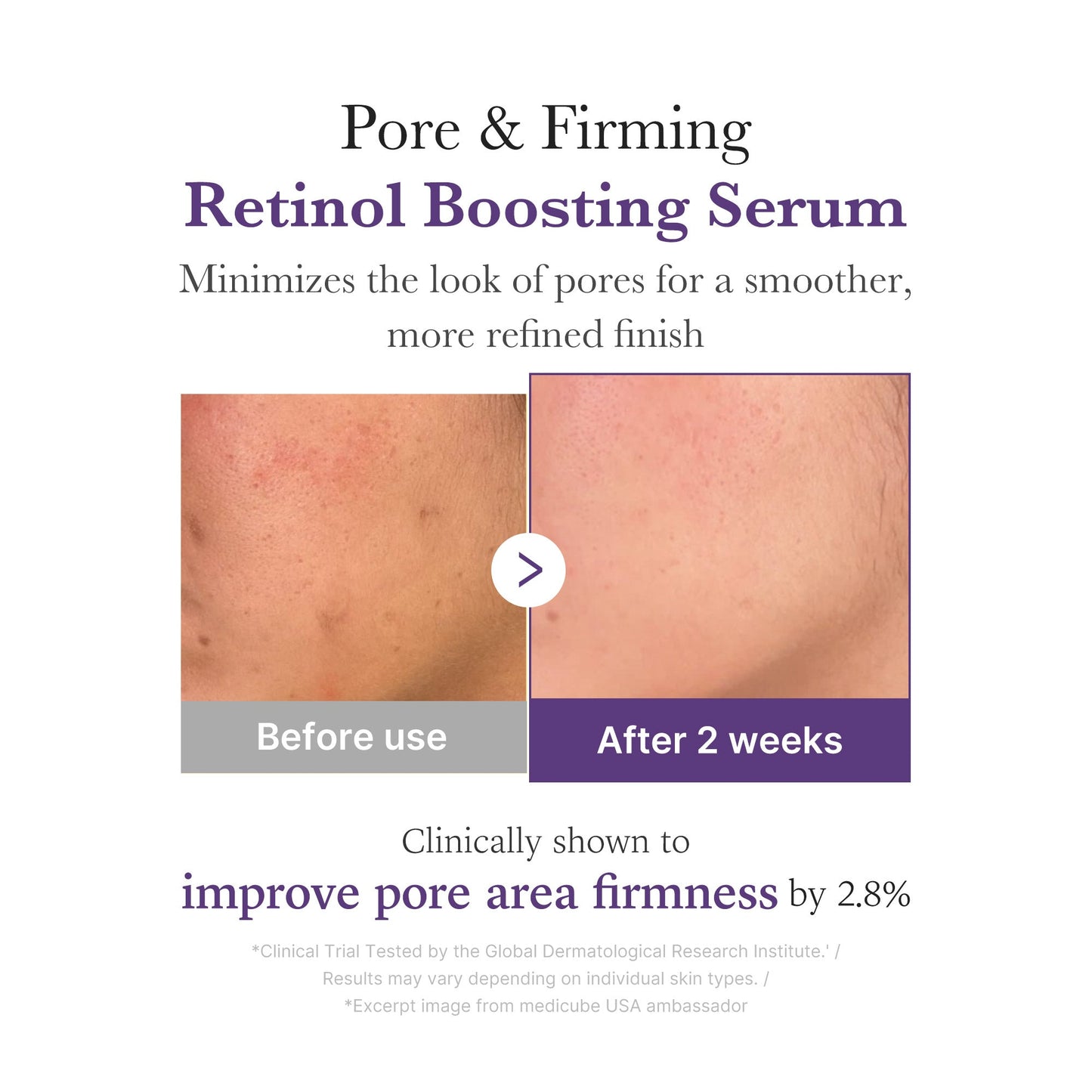 retinol-nmn-boosting-serum-g5 03_3510e7a5-5633-4a18-81ea-1389593bd517.jpg