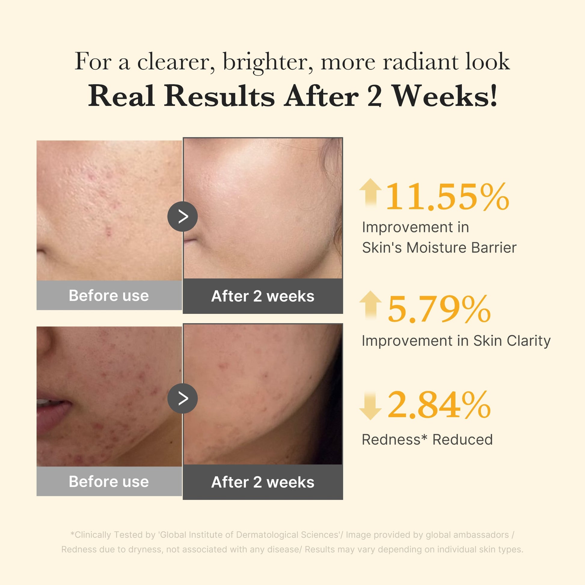 kojic-acid-turmeric-capsule-serum-z6 03_436487f5-76df-490e-8a61-01118373efbd.jpg