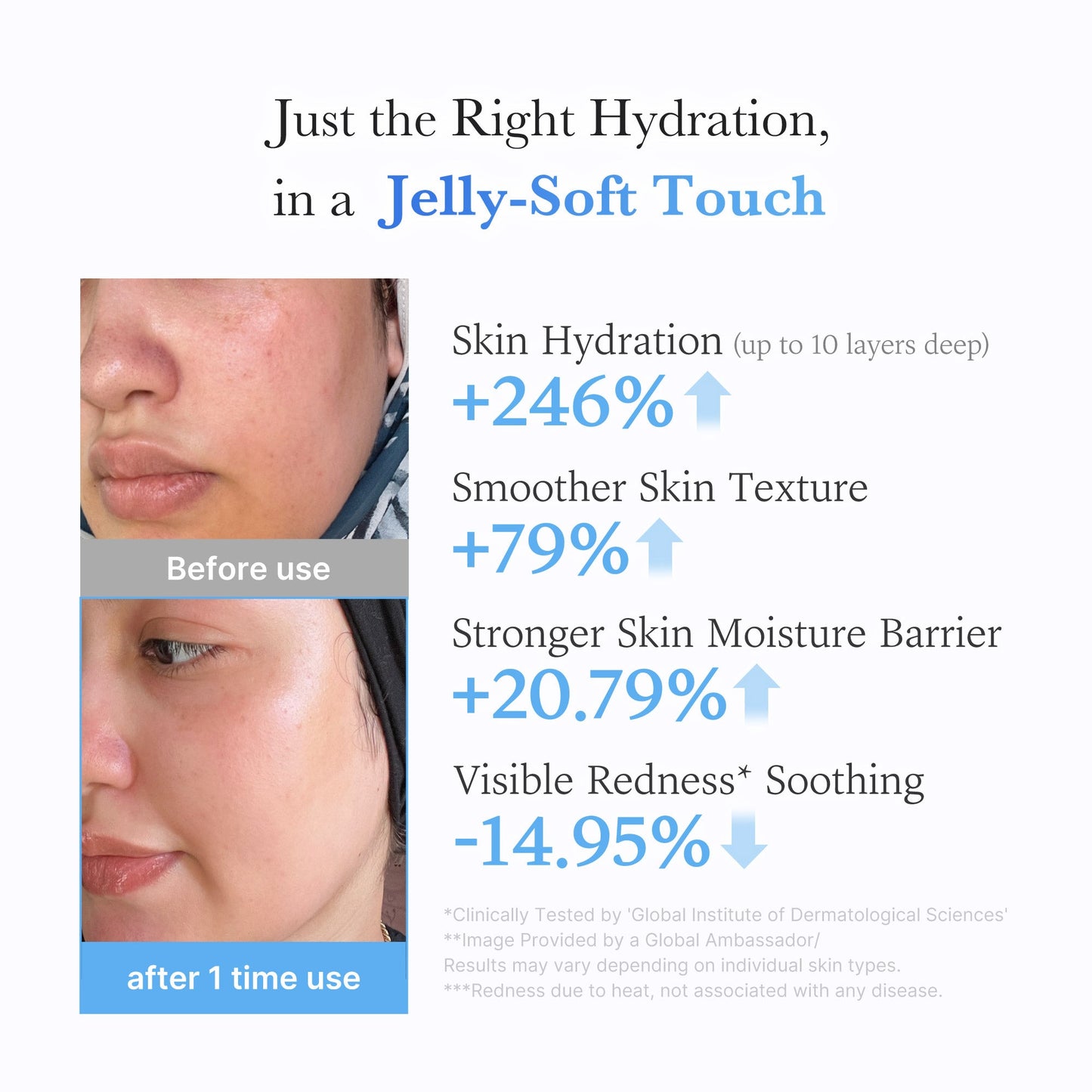 hyaluronic-ceramide-moisturizing-jelly-cream-m0 03_c39d66cc-0839-4e48-ab4a-d32143d06b1c.jpg