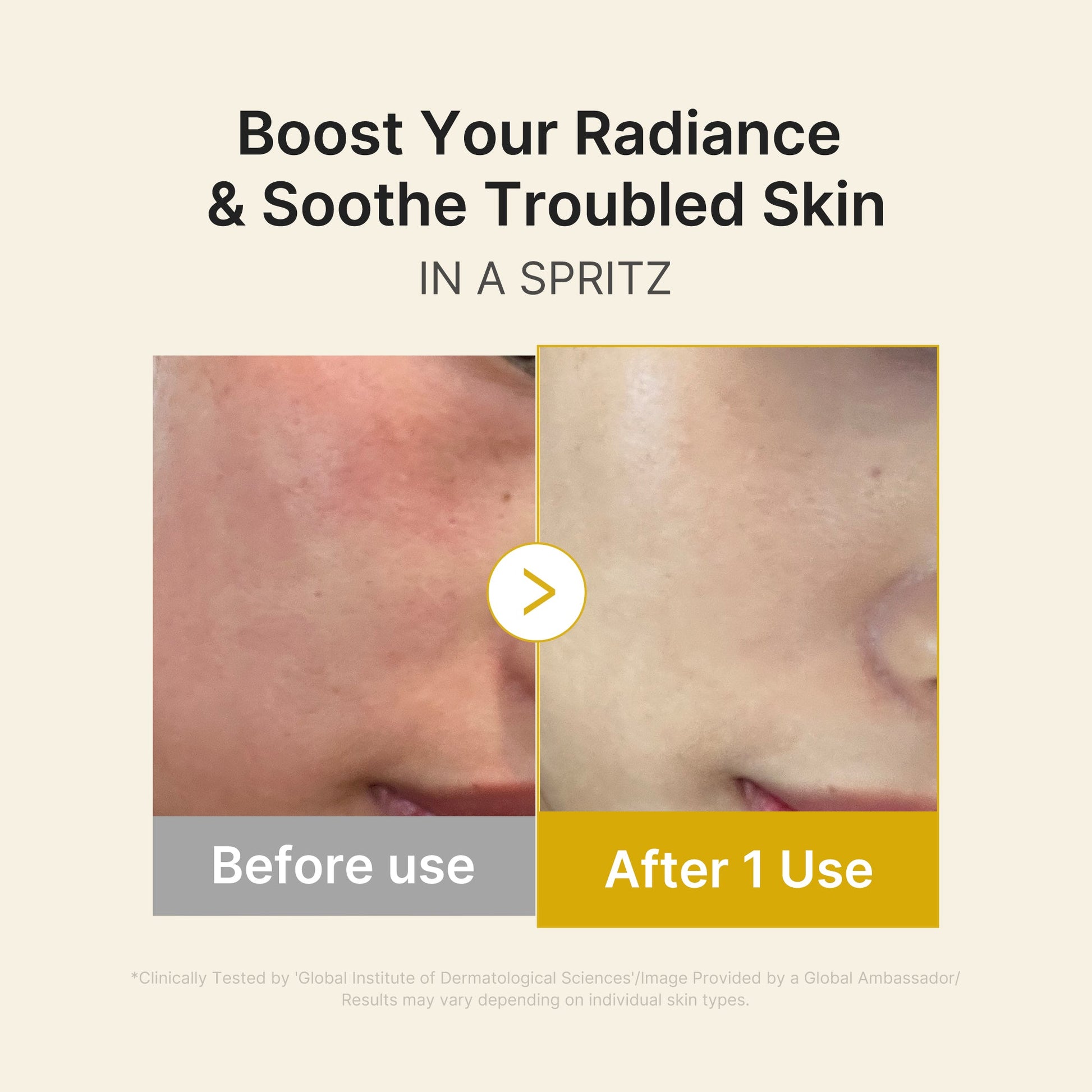 kojic-acid-turmeric-vitamin-gold-jelly-mist-serum-y2 03_dc9cd19e-4e57-49d3-9b66-c7762e8a63f1.jpg