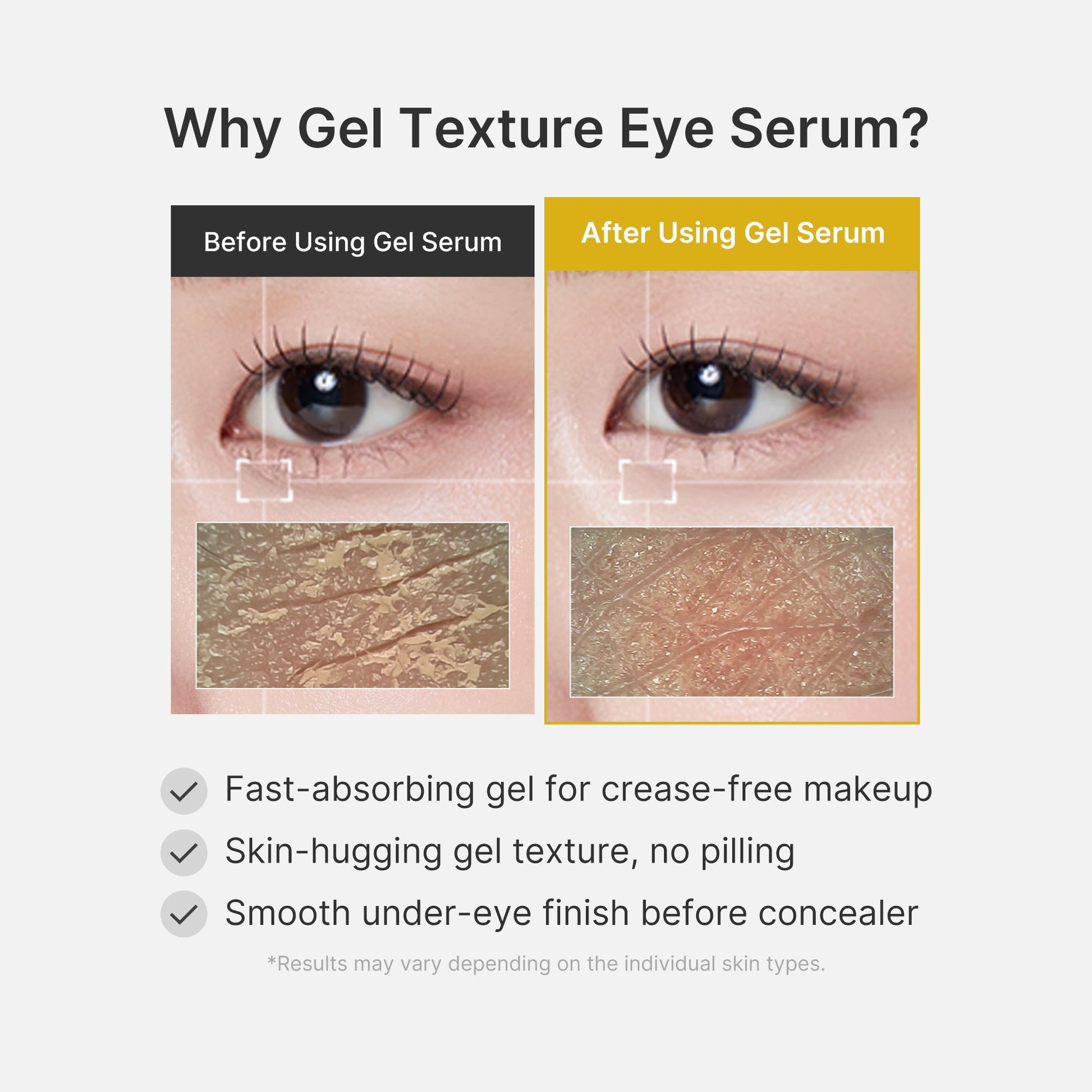 kojic-acid-tumeric-eye-gel-serum-j9 04_0487ef36-49f4-4294-8049-bb55118b05fe.jpg