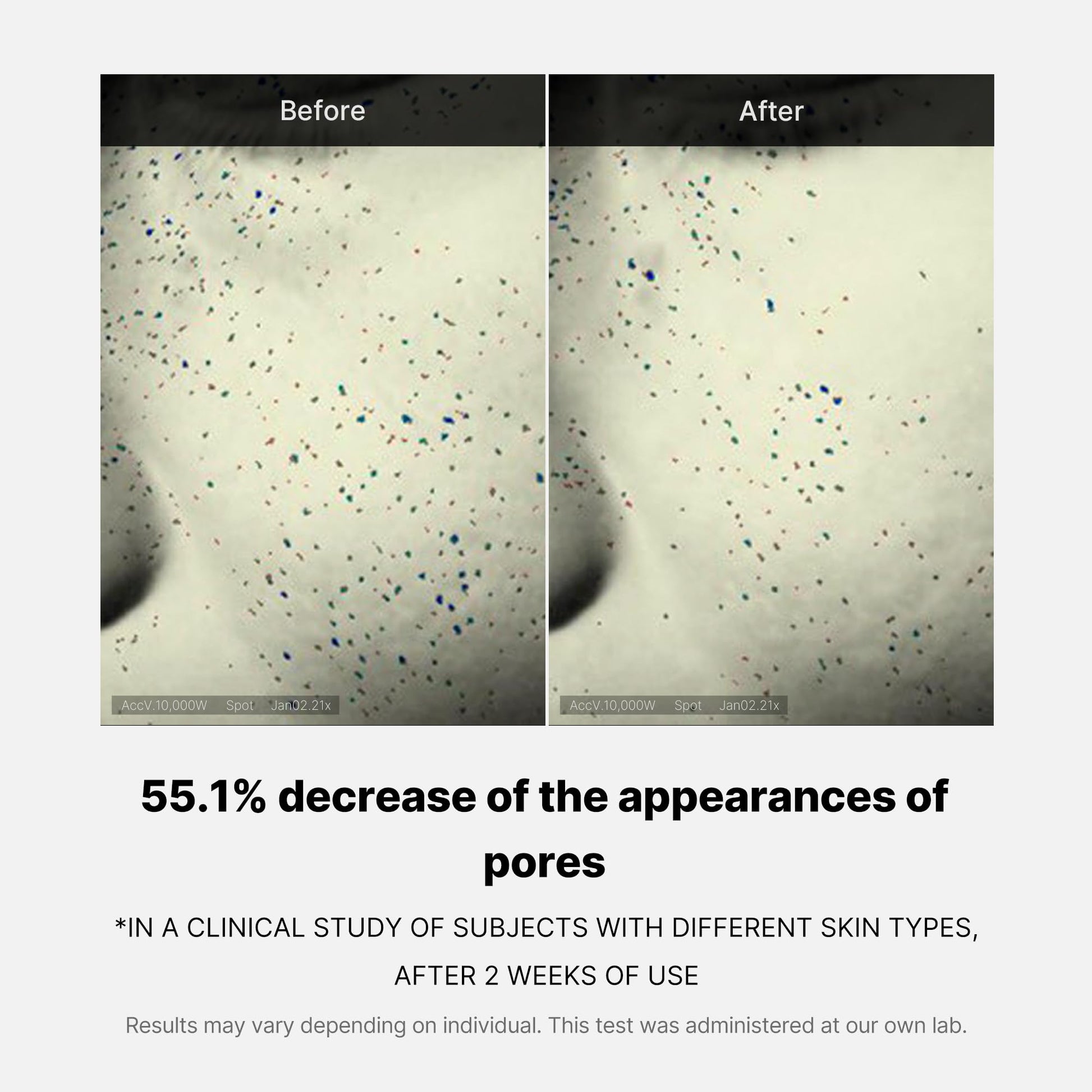 zero-pore-one-day-cream-p5 04_3616addc-f184-4deb-a5d7-e3a782e4713d.jpg