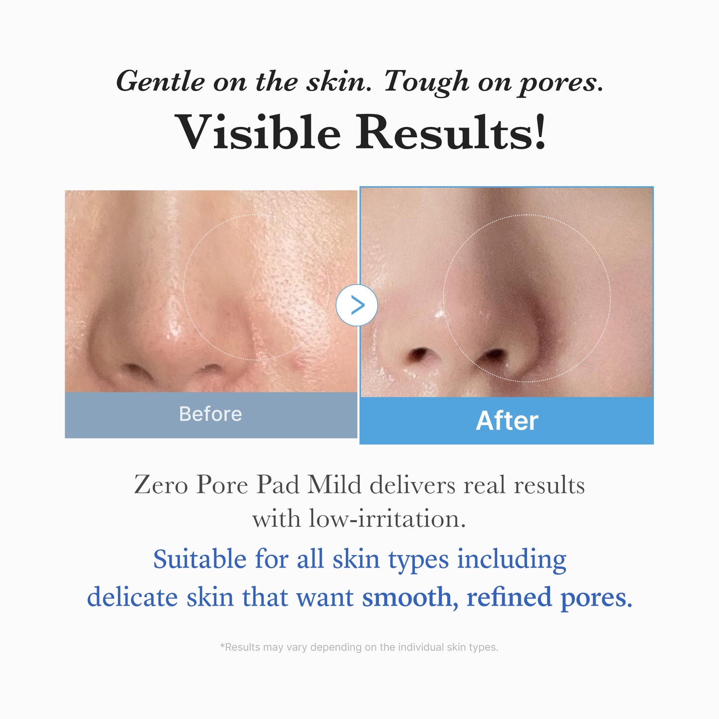 zero-pore-madecassoside-pads-mild-q8 04_6357f9f9-483b-4891-82c6-a58d336e62c8.jpg