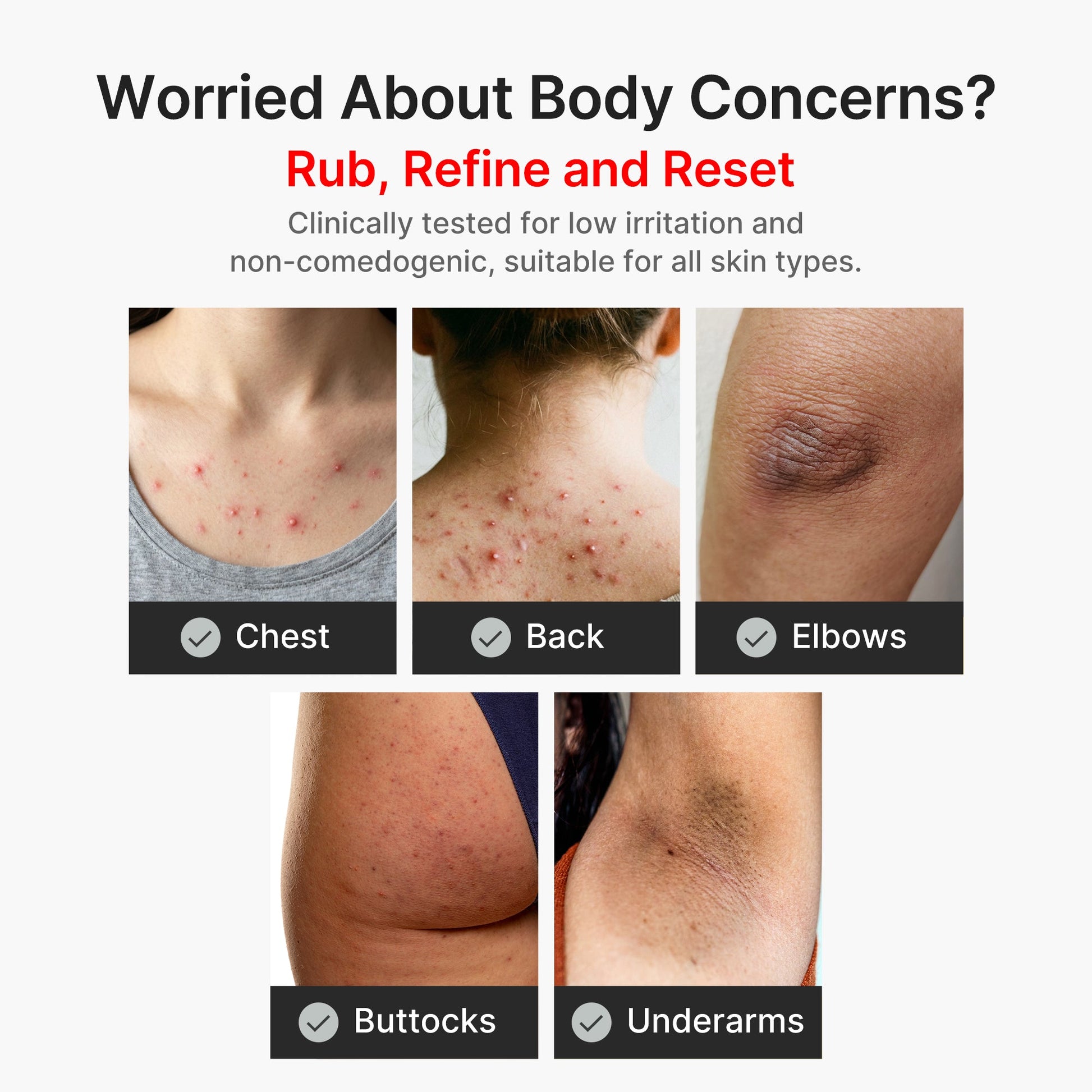 kojic-acid-turmeric-body-peel-shot-o7 04_8a7237f2-3ebf-401e-bd85-54841aeb3efc.jpg