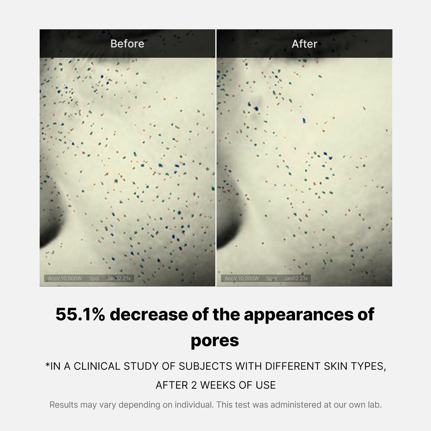 pore-care-duo-s9 05_12ddab8a-64be-4612-8ee1-27e5ec701921.jpg
