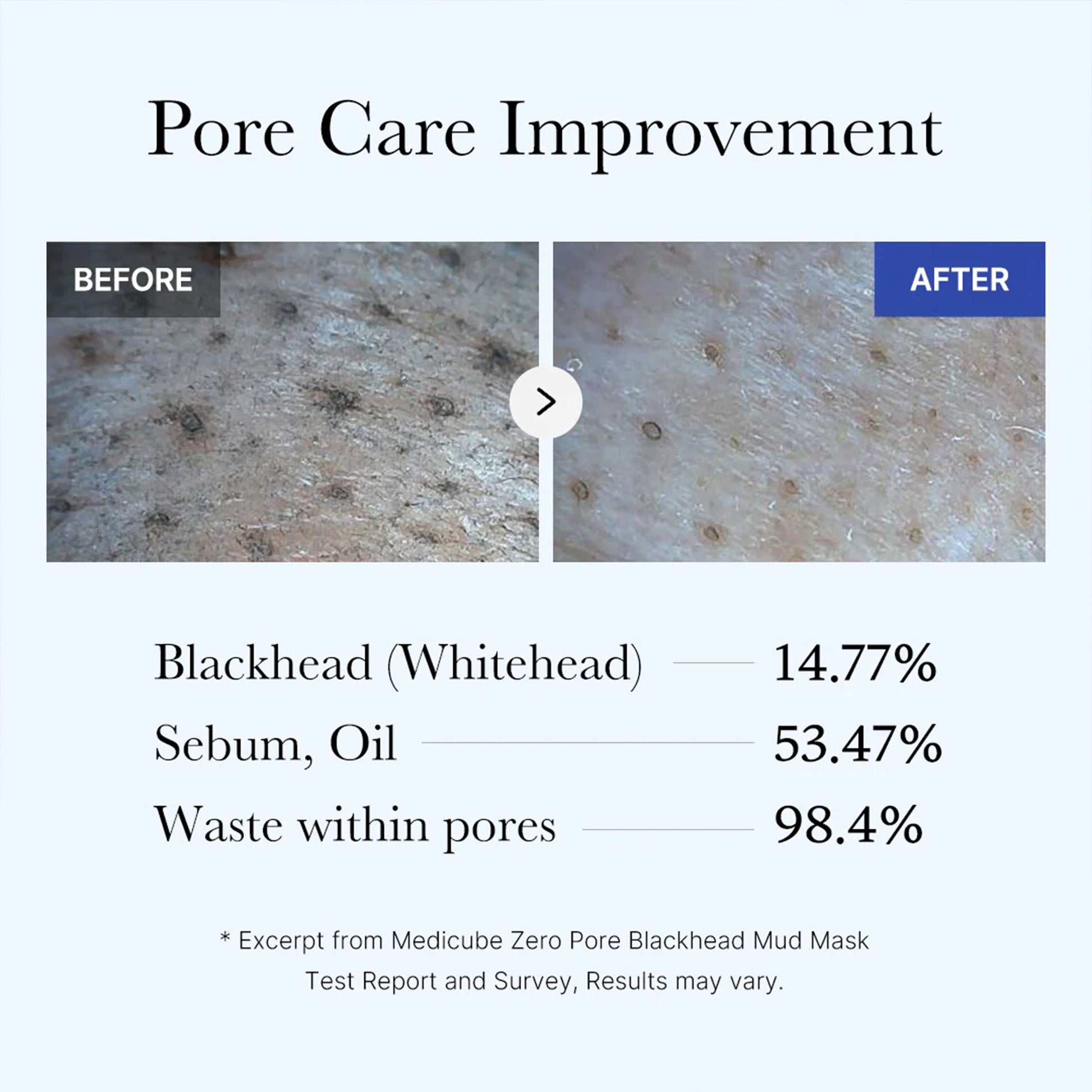 zero-pore-blackhead-mud-mask-a7 05_9362a158-c2b3-4525-acc0-631a2cfdea47.jpg