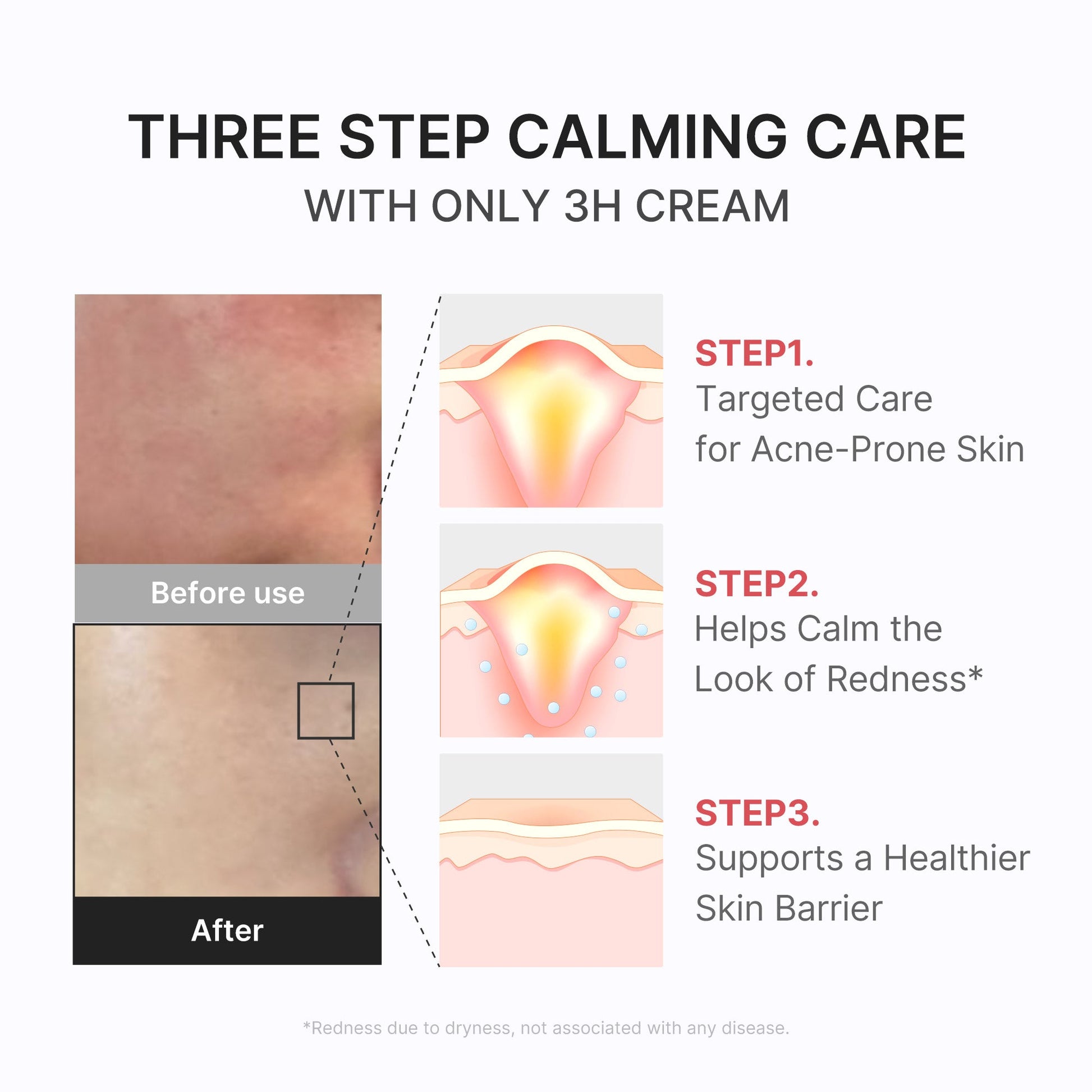 3h-daily-relief-cream-z9 3H_04.jpg