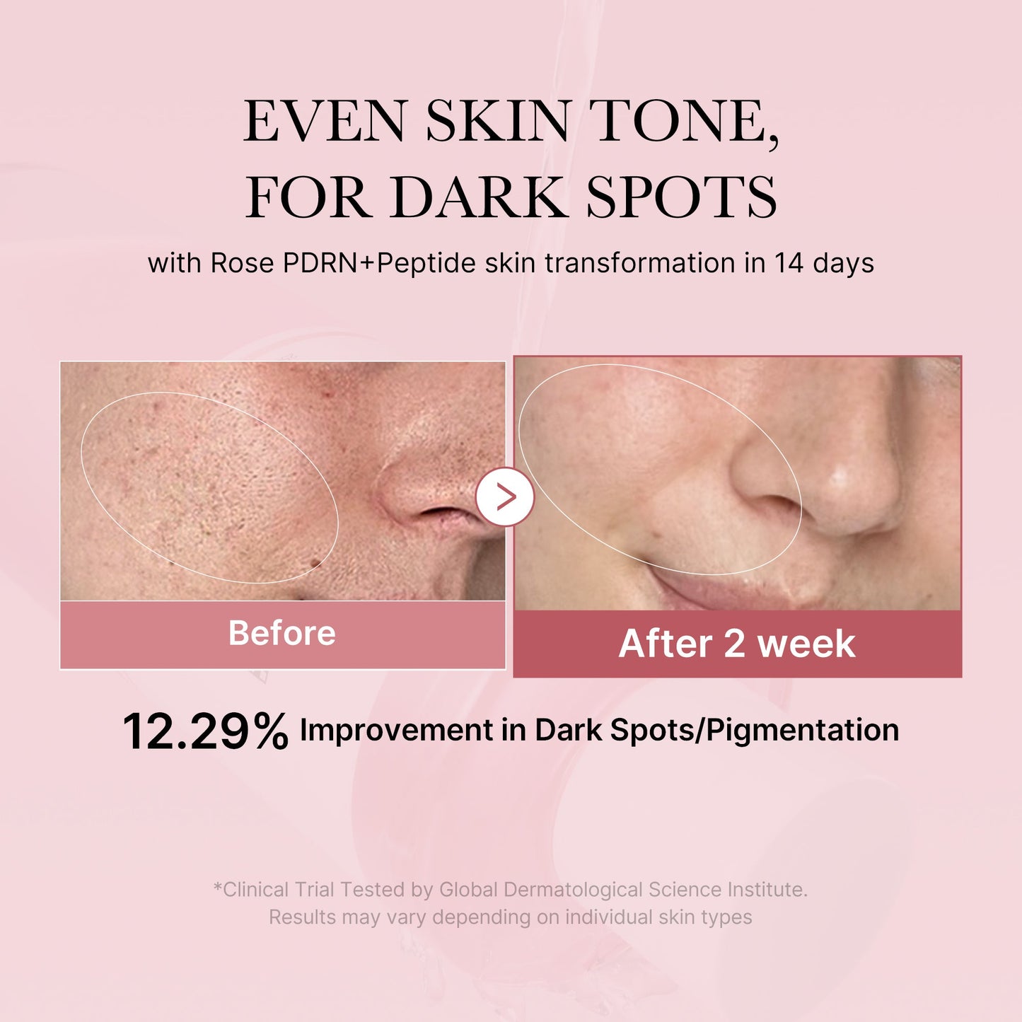 pdrn-pink-peptide-toner-f5 PDRN_01_308c518e-5ac6-4e54-99bd-eabc8796739b.jpg