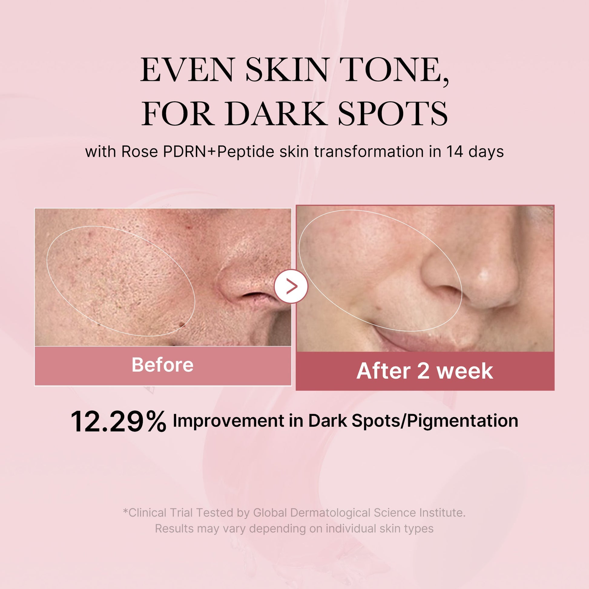 pdrn-pink-peptide-toner-f5 PDRN_01_308c518e-5ac6-4e54-99bd-eabc8796739b.jpg
