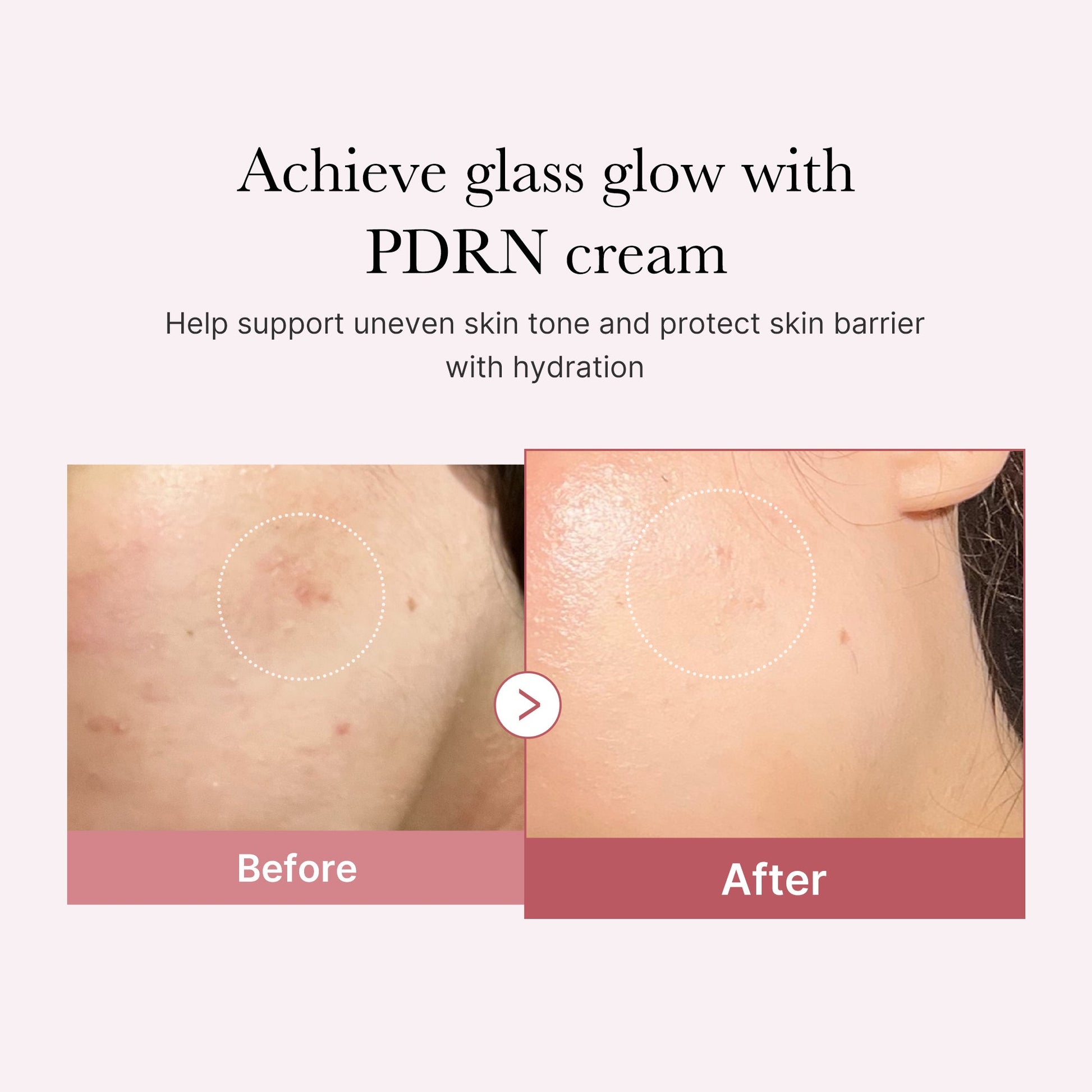 pdrn-pink-peptide-cream-y4 PDRN_02_d7805bfe-cf43-446a-b71b-a276683f136b.jpg