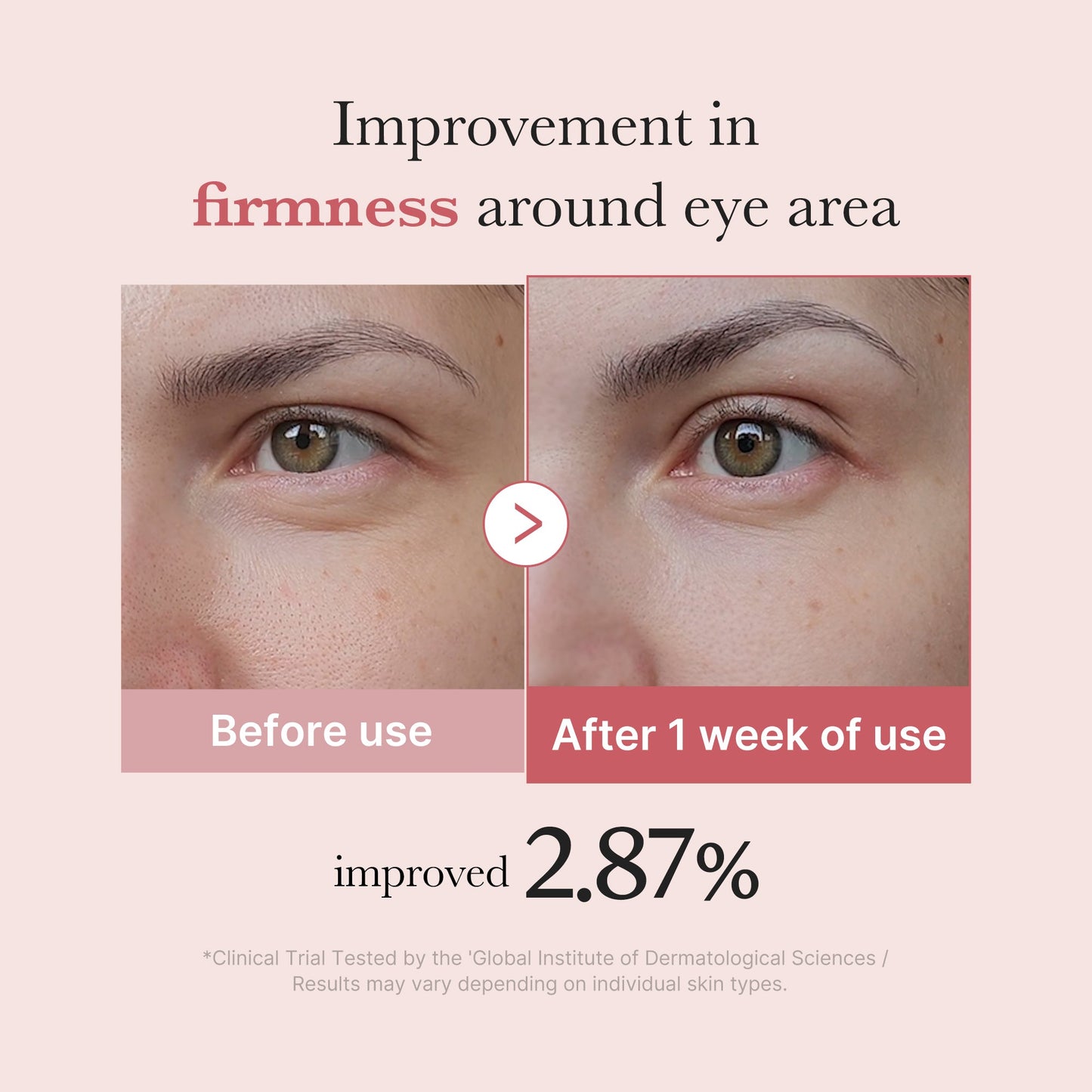pdrn-pink-peptide-eye-cream-g4 PDRN_03_256dd753-0a2f-41b4-b3cd-bbfd3bc27018.jpg