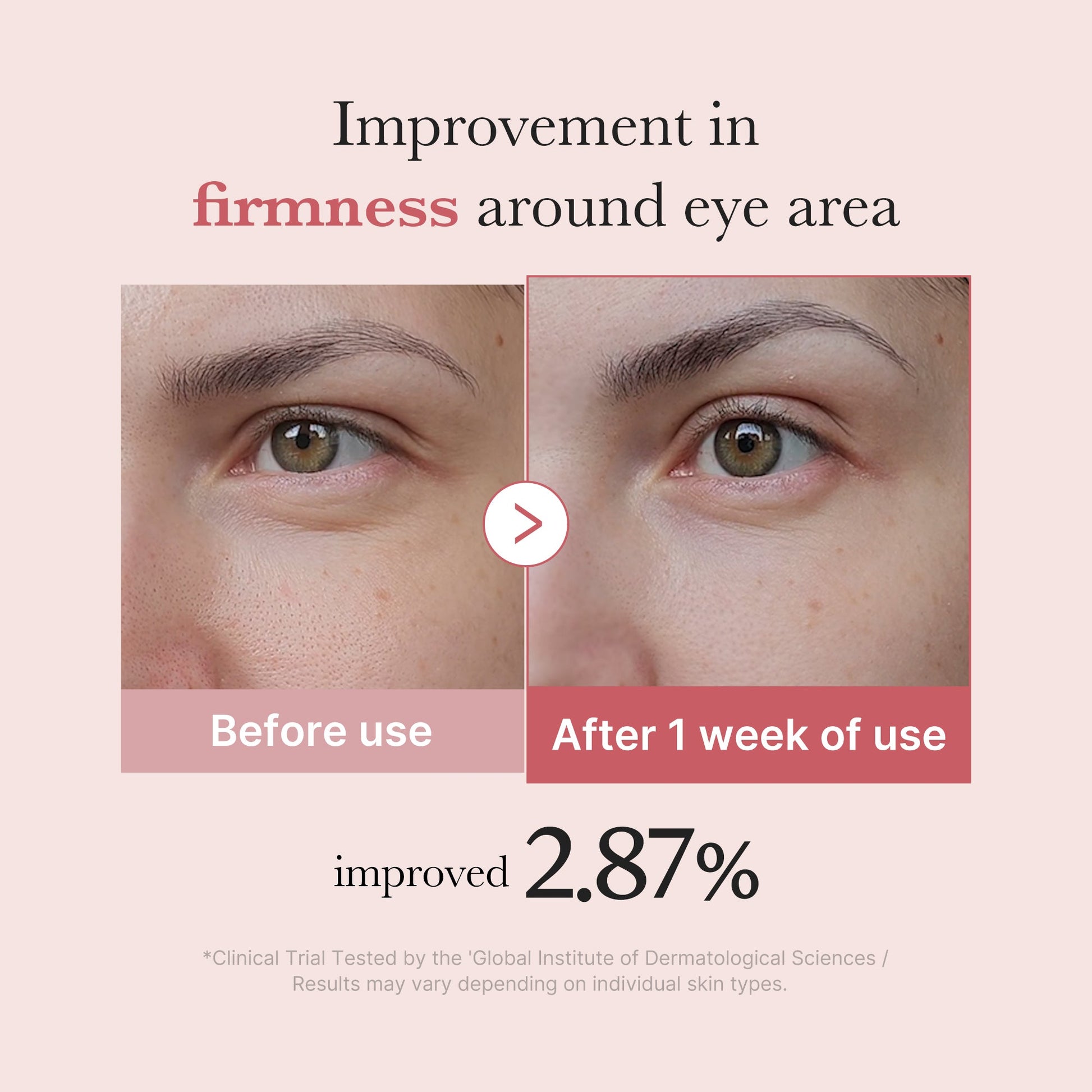 pdrn-pink-peptide-eye-cream-g4 PDRN_03_256dd753-0a2f-41b4-b3cd-bbfd3bc27018.jpg