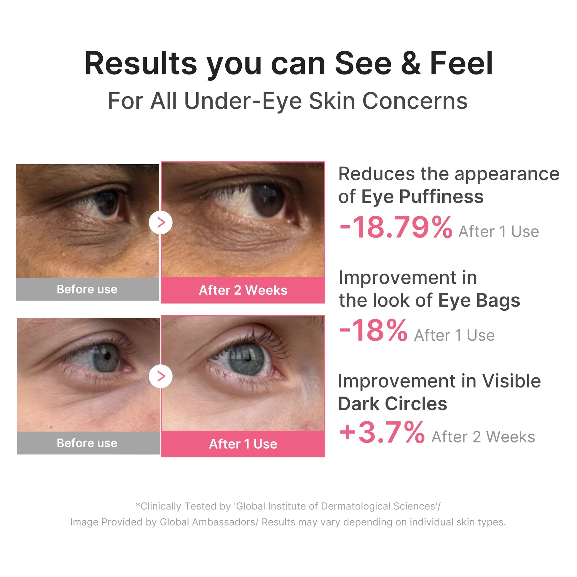 pdrn-caffeine-collagen-eye-patch-s5 PDRN_03_cdce2143-b8d8-43cb-ac69-fcbdf6640249.jpg