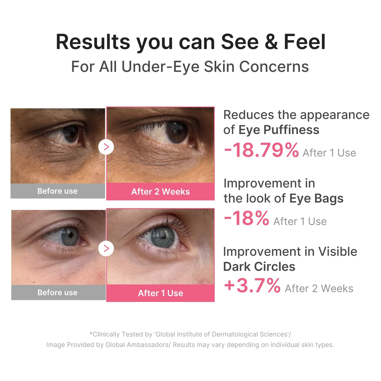 pdrn-caffeine-collagen-eye-patch-z3 PDRN_03_cdce2143-b8d8-43cb-ac69-fcbdf6640249.jpg