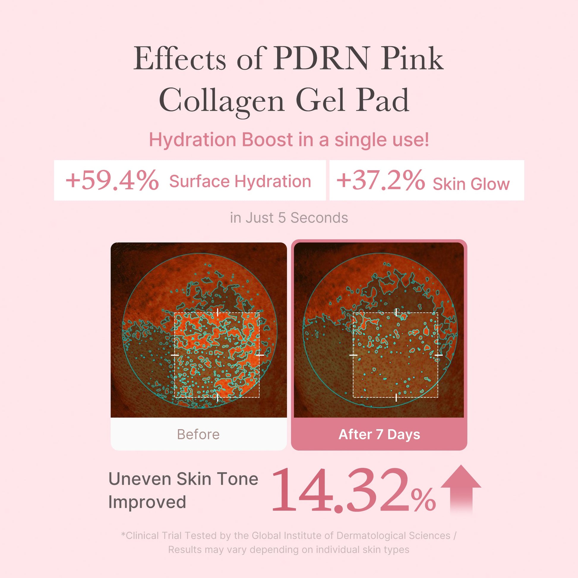 pdrn-pink-collagen-gel-toner-pad-y5 PDRN_04_f9a16a56-8d9e-4c47-a635-ed34ec3ed571.jpg