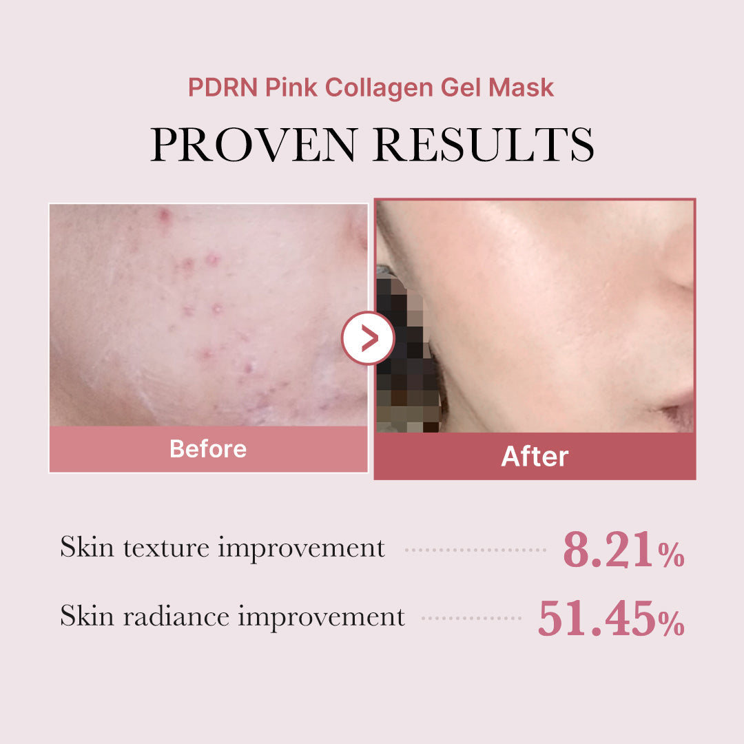 salmon-pdrn-pink-collagen-jelly-gel-mask-p6 PDRN_12.jpg